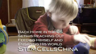Seth - CP and ONH Stem Cell Patient