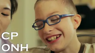 Paralisi Cerebrale Ipoplasia del nervo ottico | Testimonial del Trattamento con cellule Staminali